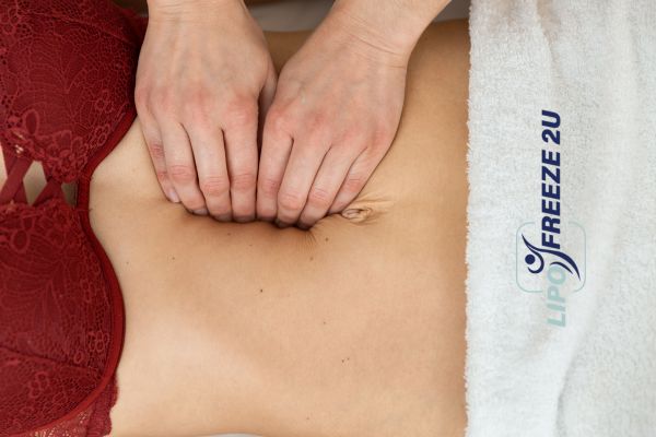 diastasis recti treatment Aylesbury
