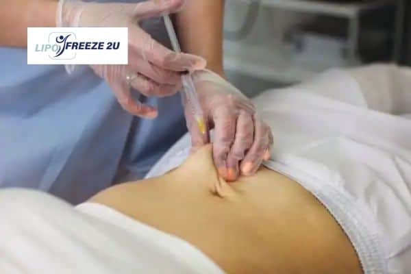 Fat Dissolving Injections Aylesbury & Weight loss medication