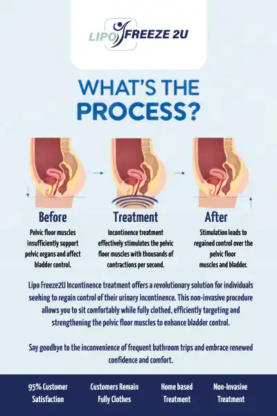 Diagram of how incontinence treatment Aylesbury works.