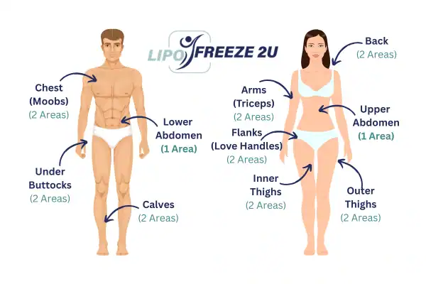 Areas you can have fat freezing treatment Aylesbury