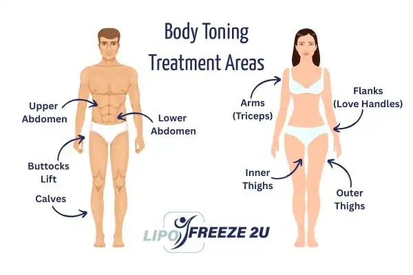 Graphic showing where you can have Body toning Treatment Aylesbury on your body