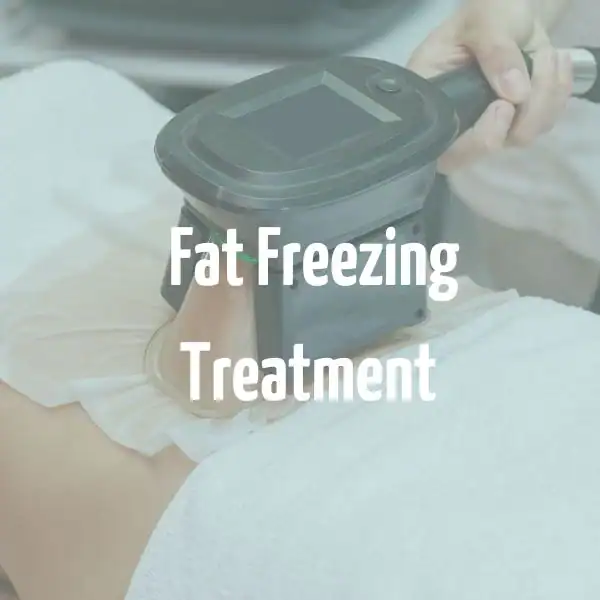 fat freezing treatment Aylesbury