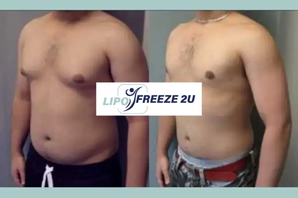 How Long Does It Take to See Results Aylesbury?