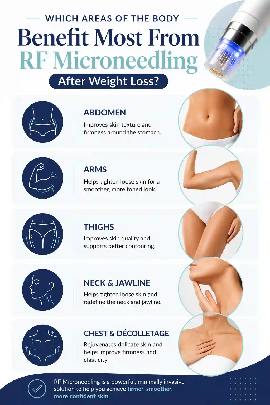 Which Areas of the Body Benefit Most From RF Microneedling After Weight Loss Aylesbury